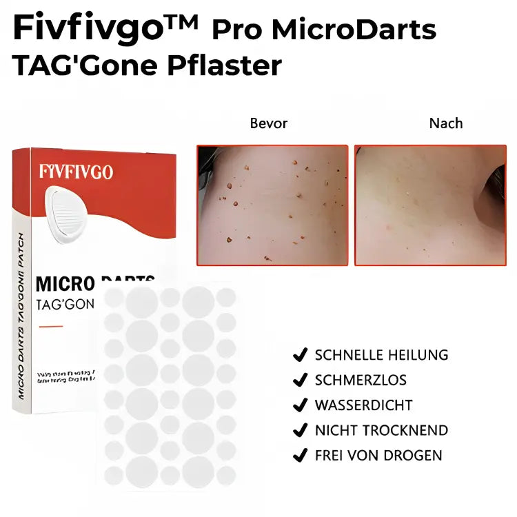 KUBOZN Pro MicroDarts Patch - Acne Pimple Patches For Face